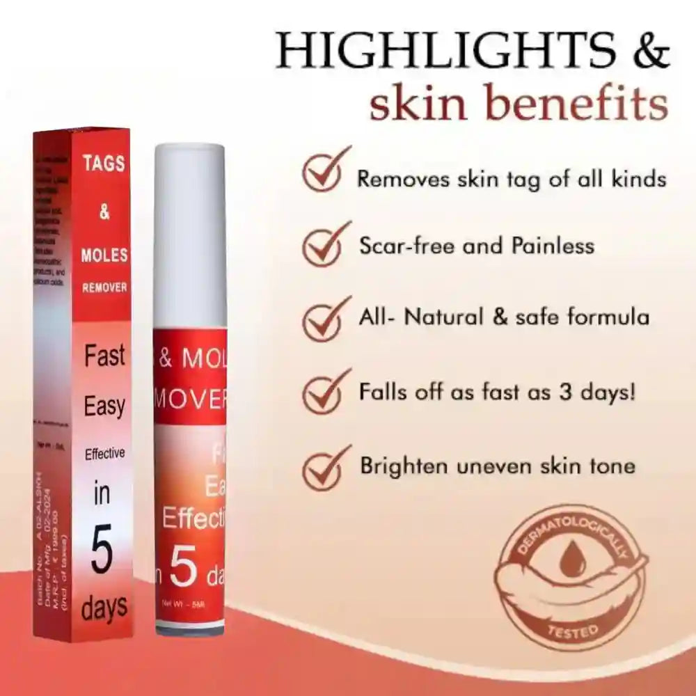 LOVILDS™ Tags & Moles Remover (Buy 1 Get 1 Free🔥🔥)