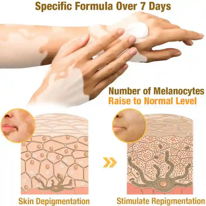 New Revitalizing Bee Venom Cream – Natural Skin Restoration & Vitality (Buy 1 Get 2 Free)