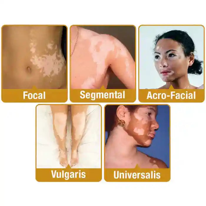 New Revitalizing Bee Venom Cream – Natural Skin Restoration & Vitality (Buy 1 Get 2 Free)