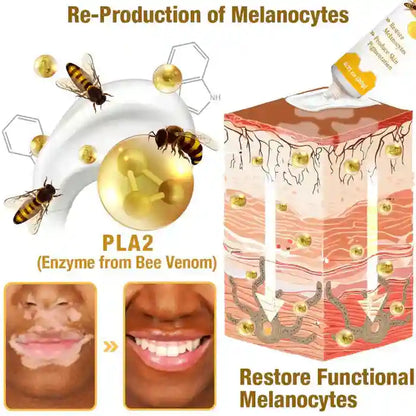 New Revitalizing Bee Venom Cream – Natural Skin Restoration & Vitality (Buy 1 Get 2 Free)